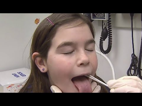 Strep A Symptoms: Key Signs to Watch For