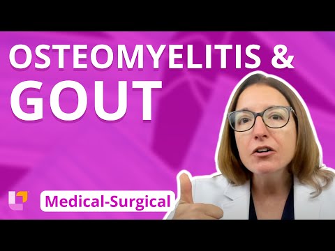 Recognizing Osteomyelitis Symptoms: Key Signs to Watch For