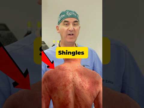 Nagin Disease: Symptoms, Causes, and Treatment Options