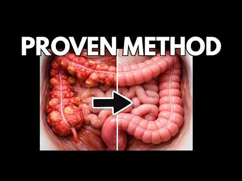 Effective Approaches to Diverticulitis Treatment Options