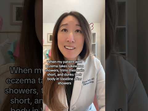 Atopic Dermatitis Symptoms: What to Look For and Manage