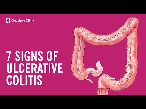 Ulcerative Colitis Symptoms: Recognizing the Warning Signs
