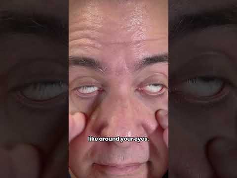 Symptoms of Dehydration in Women: What to Watch For