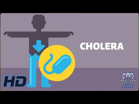 Cholera Disease: Symptoms, Causes, and Prevention Methods