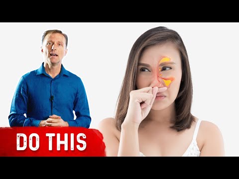 Effective Management of Sinus Drainage Issues