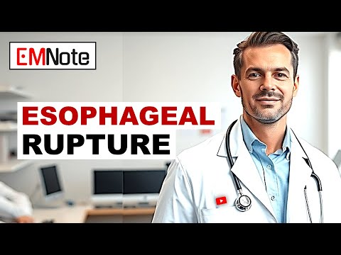 Boerhaave Syndrome: Critical Insights and Management Strategies