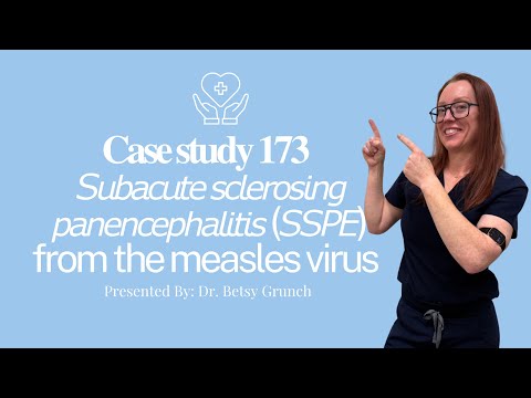 Understanding Subacute Sclerosing Panencephalitis Symptoms and Treatment