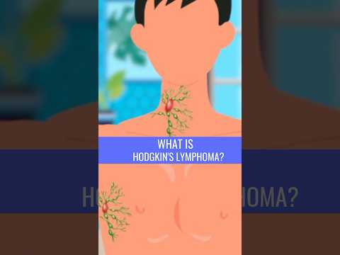 Hodgkin's Lymphoma Symptoms: Key Signs to Watch For