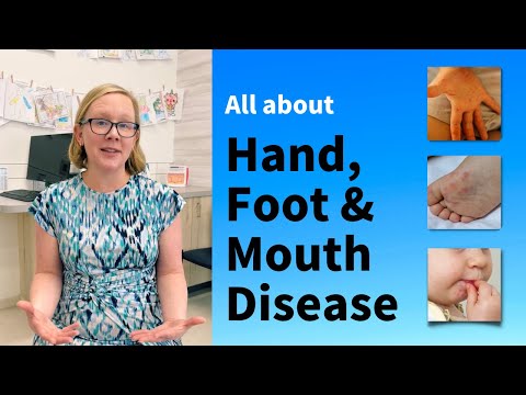 Hand Foot Conditions: Symptoms, Causes, and Treatments