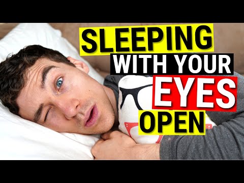 Sleeping with Eyes Open: Causes and Effects Explained
