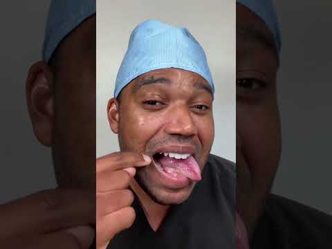 Red Spots on Tongue: Causes and Treatment Options