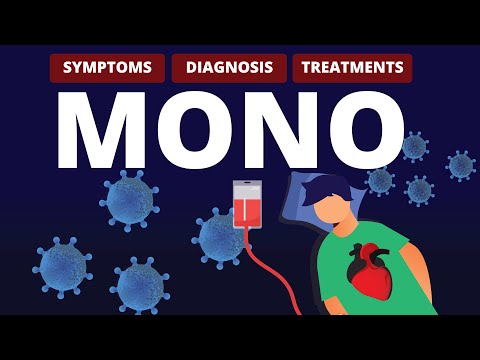Managing Mono Throat: Symptoms and Treatment Options