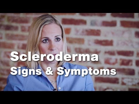 Crest Disease: Symptoms, Causes, and Treatment Options