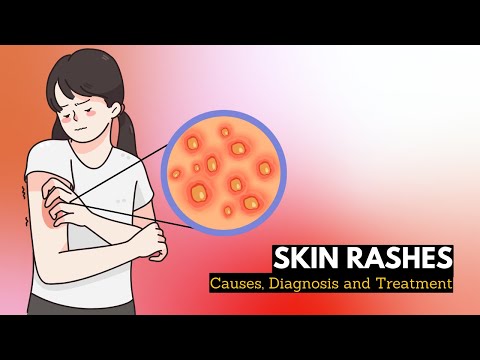 Rashes: Causes, Symptoms, and Psychological Connections
