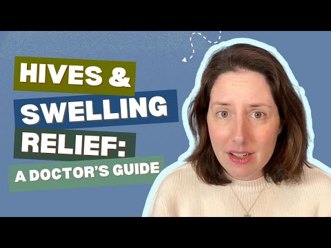 Hives on Face: Causes, Symptoms, and Treatment Options