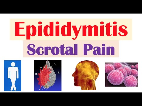 Epididymitis Symptoms: Recognizing the Key Signs and Discomfort