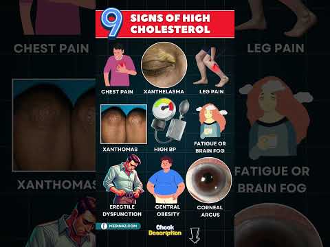 Signs of High Cholesterol You Shouldn't Ignore