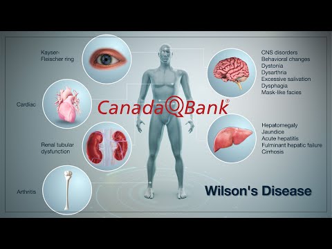 Recognizing Wilson Disease Symptoms and Their Impact