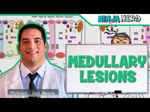 Understanding Lateral Medullary Syndrome and Its Effects