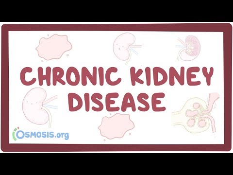 Chronic Kidney Disease Diagnosis: Key Tests and Indicators