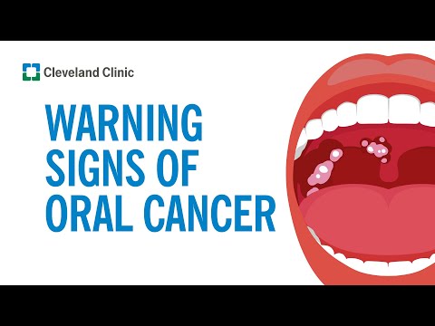 Recognizing Mouth Cancer Symptoms: Key Signs to Watch For