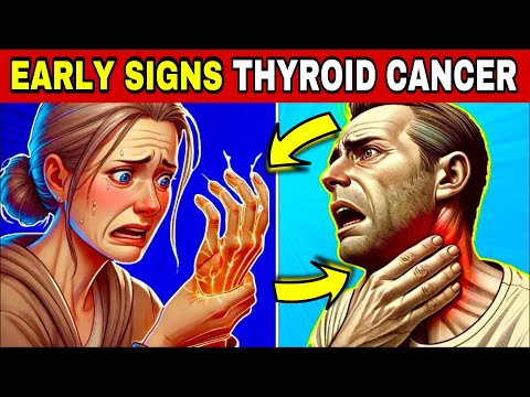 Signs of Thyroid Cancer You Should Not Ignore
