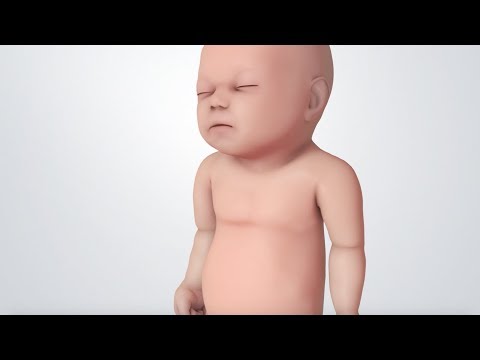 Understanding Newborn Snoring: Causes and Concerns