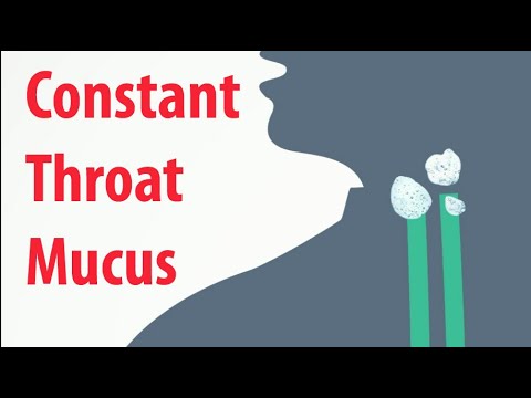 Mucus Stuck Between Nose and Throat: Causes and Relief