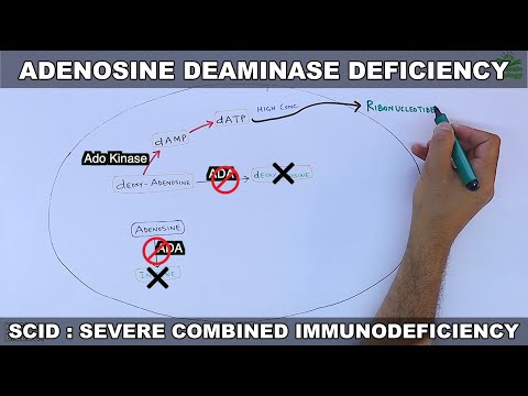 Adenosine Deaminase Deficiency: Causes and Implications