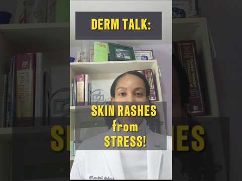 Hives Caused by Stress: Uncovering the Connection