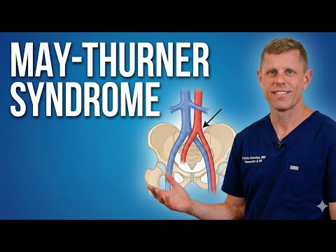 Hoyeraal Hreidarsson Syndrome: Causes, Symptoms, and Insights