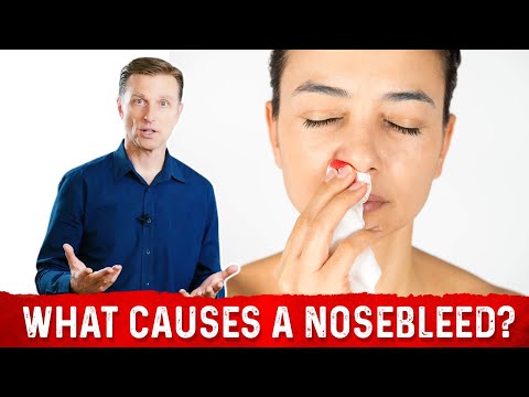Nosebleeds Due to Stress: Causes and Connections Explained