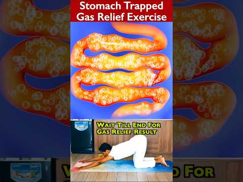 Trapped Gas for Days: Causes, Symptoms, and Relief Options