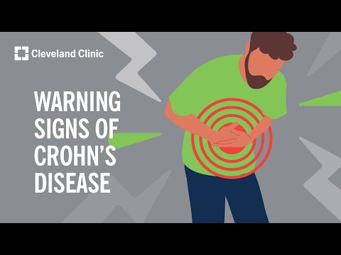 Crohn's Disease Symptoms Unique to Females Explained
