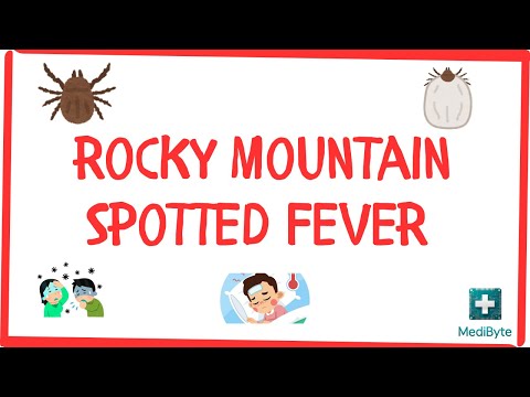 RMSF: Symptoms, Causes, and Treatment Options Explained