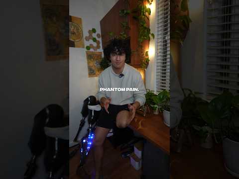 Phantom Limb Syndrome: Understanding Its Causes and Effects