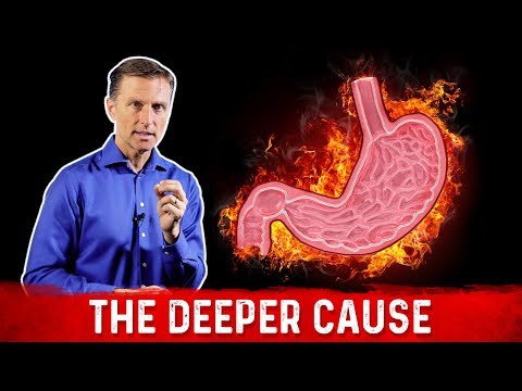 Acid Reflux Causes Stress: Understanding the Connection