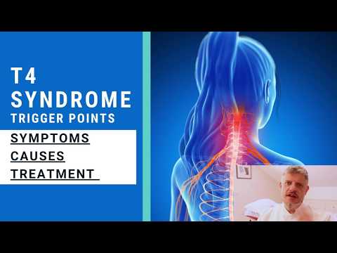 T4 Syndrome: Symptoms, Causes, and Treatment Options