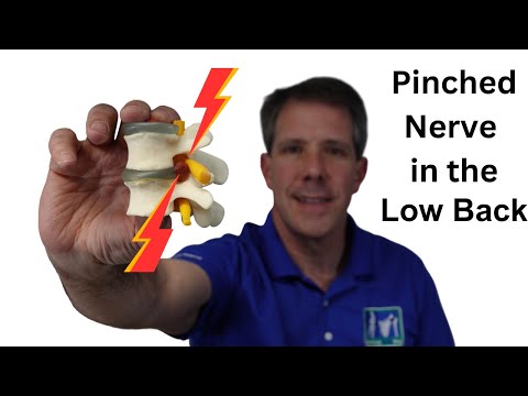 Symptoms of a Pinched Nerve in the Lower Back Explained
