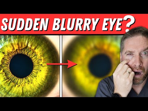 Blurry Vision, Headache, and Fatigue: Common Causes Explained