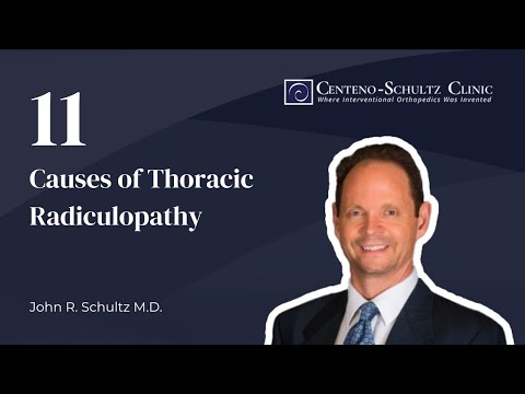 Thoracic Radiculopathy: Symptoms, Causes, and Treatment
