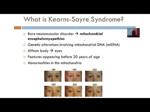 Kearns Sayre Syndrome: Symptoms, Causes, and Management