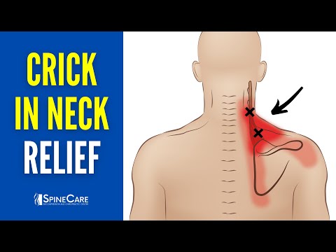 Effective Strategies for Managing Neck Strain Symptoms