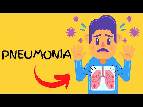 Understanding Lemonia Disease: Symptoms and Treatment Options