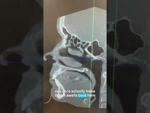 Sensation in Teeth: Causes and Psychological Connections