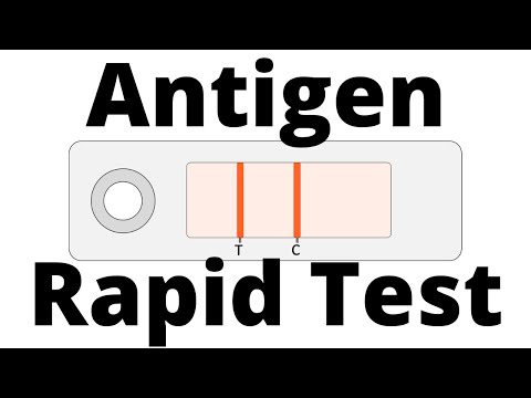 Understanding Antigen Tests: What You Need to Know